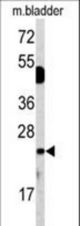 Western blot of DUSP14 antibody in mouse bladder tissue lysates (35 ug/lane). DUSP14 (arrow) was detected using the purified antibody.