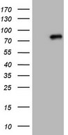 HEK293T cells were transfected with the pCMV6-ENTRY control (Left lane) or pCMV6-ENTRY CLINT1 (Right lane) cDNA for 48 hrs and lysed. Equivalent amounts of cell lysates (5 ug per lane) were separated by SDS-PAGE and immunoblotted with anti-CLINT1.
