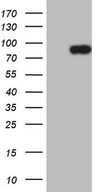 HEK293T cells were transfected with the pCMV6-ENTRY control (Left lane) or pCMV6-ENTRY CLINT1 (Right lane) cDNA for 48 hrs and lysed. Equivalent amounts of cell lysates (5 ug per lane) were separated by SDS-PAGE and immunoblotted with anti-CLINT1.