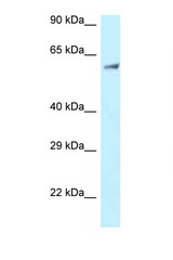 CLINT1 antibody LS-C145831 Western blot of Jurkat Cell lysate. Antibody concentration 1 ug/ml.