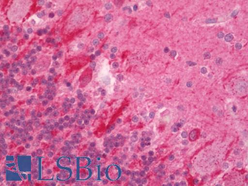 Human Brain, Cerebellum: Formalin-Fixed, Paraffin-Embedded (FFPE) 