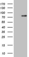 HEK293T cells were transfected with the pCMV6-ENTRY control (Left lane) or pCMV6-ENTRY CLINT1 (Right lane) cDNA for 48 hrs and lysed. Equivalent amounts of cell lysates (5 ug per lane) were separated by SDS-PAGE and immunoblotted with anti-CLINT1.