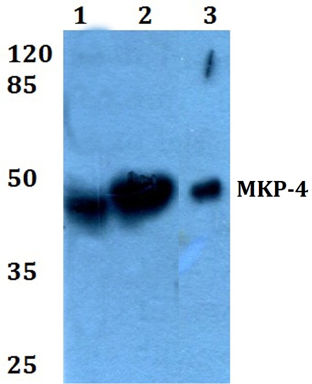 Western blot analysis of Anti-DUSP9 Antibody at 1:500 dilution. Lane 1: HEK293T whole cell lysate. Lane 2: H9C2 whole cell lysate. Lane 3: PC12 whole cell lysate.