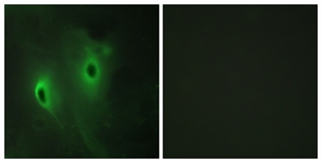 Immunofluorescence of HeLa cells, using DUSP9 Antibody. The picture on the right is treated with the synthesized peptide.