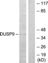 Western blot of extracts from HeLa cells, using DUSP9 Antibody. The lane on the right is treated with the synthesized peptide.