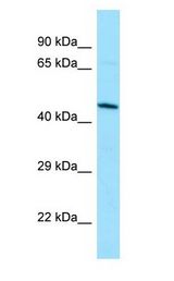 DUSP9 antibody Western Blot of Jurkat.