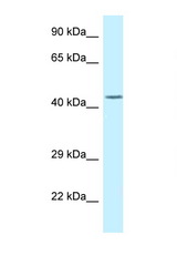 DUSP9 antibody LS-C145632 Western blot of Fetal Brain lysate. Antibody concentration 1 ug/ml.