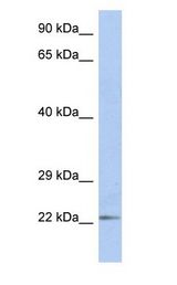 DUT / DUTPase antibody Western Blot of Fetal Small Intestine cell lysate.