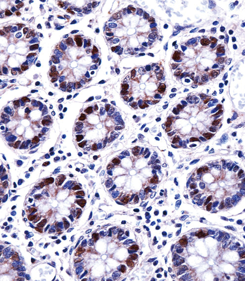 DUT Antibody immunohistochemistry of formalin-fixed and paraffin-embedded human colon tissue followed by peroxidase-conjugated secondary antibody and DAB staining.