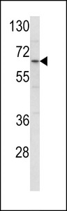 Western blot of ENTH Antibody in HL-60 cell line lysates (35 ug/lane). ENTH (arrow) was detected using the purified antibody.