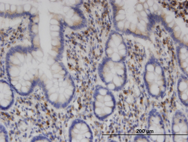Immunoperoxidase of monoclonal antibody to CLINT1 on formalin-fixed paraffin-embedded human small Intestine. [antibody concentration 3 ug/ml]