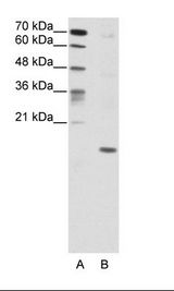 A: Marker, B: HepG2 Cell Lysate