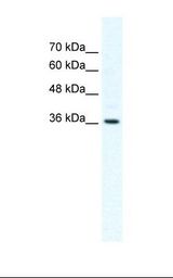 HepG2 cell lysate. Antibody concentration: 2.5 ug/ml. Gel concentration: 12%.
