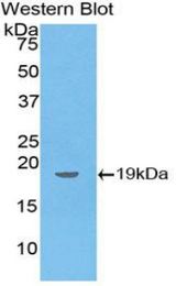 Western blot of recombinant DVL1 / DVL / Dishevelled.