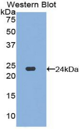 Western blot of recombinant DVL1 / DVL / Dishevelled.