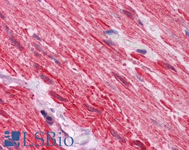 Anti-DVL2 / Dishevelled 2 antibody IHC of human small intestine, muscularis propria. Immunohistochemistry of formalin-fixed, paraffin-embedded tissue after heat-induced antigen retrieval. Antibody LS-B5586 concentration 5 ug/ml.