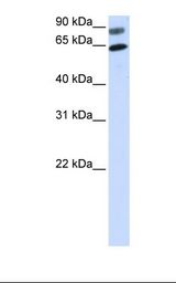 Transfected 293T cell lysate. Antibody concentration: 1.0 ug/ml. Gel concentration: 12%.