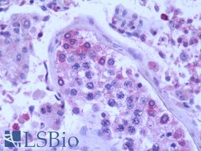 Human, Testis:Formalin-Fixed Paraffin-Embedded (FFPE)