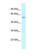 CLINT1 antibody LS-C145830 Western blot of Fetal Lung lysate. Antibody concentration 1 ug/ml.