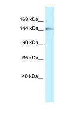 CLIP1 / CLIP170 antibody LS-C145323 Western blot of Fetal Liver lysate. Antibody concentration 1 ug/ml.