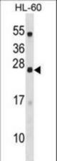 C18orf26 Antibody western blot of HL-60 cell line lysates (35 ug/lane). The C18orf26 antibody detected the C18orf26 protein (arrow).