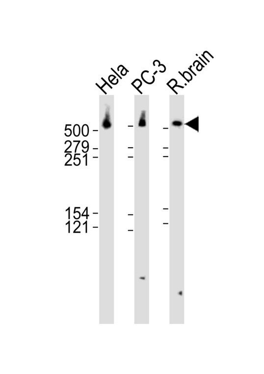 Western blot of lysates from HeLa, PC-3 cell line and rat brain tissue lysate (from left to right) with DYNC1H1 Antibody. Antibody was diluted at 1:1000 at each lane. A goat anti-rabbit IgG H&L (HRP) at 1:10000 dilution was used as the secondary antibody. Lysates at 35 ug per lane.