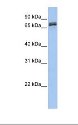 Fetal brain lysate. Antibody concentration: 1.0 ug/ml. Gel concentration: 12%.