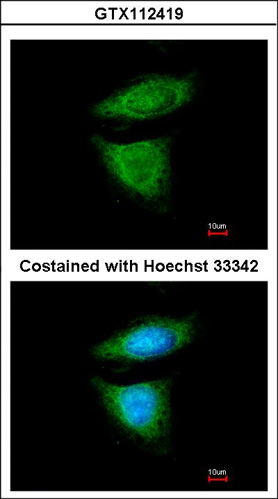 Immunofluorescence of methanol-fixed HeLa using DYNC1I2 antibody at 1:200 dilution.