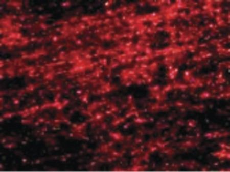 Immunofluorescence of CLIP170 in human brain tissue with CLIP170 antibody at 20 ug/ml.