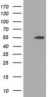 HEK293T cells were transfected with the pCMV6-ENTRY control (Left lane) or pCMV6-ENTRY DYNC1LI1 (Right lane) cDNA for 48 hrs and lysed. Equivalent amounts of cell lysates (5 ug per lane) were separated by SDS-PAGE and immunoblotted with anti-DYNC1LI1.