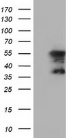 HEK293T cells were transfected with the pCMV6-ENTRY control (Left lane) or pCMV6-ENTRY DYNC1LI1 (Right lane) cDNA for 48 hrs and lysed. Equivalent amounts of cell lysates (5 ug per lane) were separated by SDS-PAGE and immunoblotted with anti-DYNC1LI1.