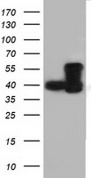 HEK293T cells were transfected with the pCMV6-ENTRY control (Left lane) or pCMV6-ENTRY DYNC1LI1 (Right lane) cDNA for 48 hrs and lysed. Equivalent amounts of cell lysates (5 ug per lane) were separated by SDS-PAGE and immunoblotted with anti-DYNC1LI1.