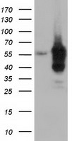 HEK293T cells were transfected with the pCMV6-ENTRY control (Left lane) or pCMV6-ENTRY DYNC1LI1 (Right lane) cDNA for 48 hrs and lysed. Equivalent amounts of cell lysates (5 ug per lane) were separated by SDS-PAGE and immunoblotted with anti-DYNC1LI1.
