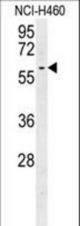 DYNC1LI2 Antibody western blot of NCI-H460 cell line lysates (35 ug/lane). The DYNC1LI2 antibody detected the DYNC1LI2 protein (arrow).