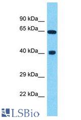 DYNC1LI2 antibody Western Blot of COLO205. Antibody dilution: 1 ug/ml.