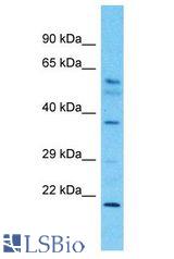 DYNC2LI1 / D2LIC antibody Western Blot of Fetal Kidney. Antibody dilution: 1 ug/ml.