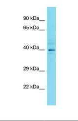 Western blot of Jurkat. DYNC2LI1 antibody dilution 1.0 ug/ml.