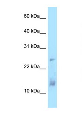 DYNLL1 antibody LS-C146101 Western blot of Jurkat Cell lysate. Antibody concentration 1 ug/ml.