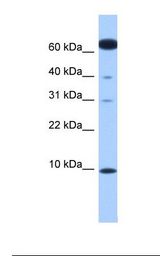 Fetal heart lysate. Antibody concentration: 1.0 ug/ml. Gel concentration: 10-20%.