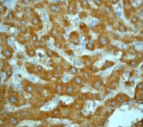 IHC of paraffin-embedded human liver using anti-DLC8 antibody.