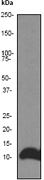 Western blot analysis on HeLa cell lysate using anti-DLC8 antibody, dilution 1:10000.