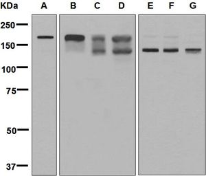 Western blot analysis on (A) 293T, (B) HeLa, (C) fetal kidney, (D) HepG2, (E) A549, (F) HUVEC, and (G) MCF-7 cell lysates using anti-CLIP1 / CLIP170 antibody.
