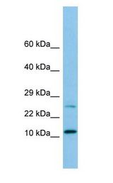 DYNLRB1 antibody Western Blot of HeLa.