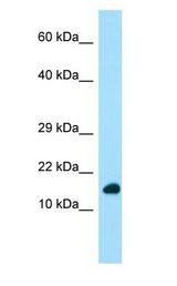 DYNLRB1 antibody Western Blot of Fetal Heart.