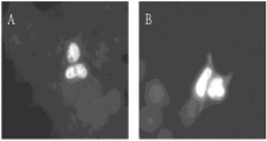 Immunoprecipitation of Dyrk from 293T transfected cells. Immunoprecipitation with - 1) control Ab, 2) Anti-MNP 2 ug/ml, 3) anti-Dyrk 2 ug/ml, 4) anti-Dyrk 10 ug/ml, 5) competitor?s anti-Dyrk Ab 10 ug/ml, Western blot performed with anti-Dyrk Ab at 2 ug/ml.