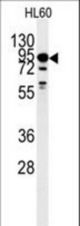 Western blot of DYRK1A Antibody polyclonal antibody in HL60 cell line lysates (35 ug/lane). DYRK1A (arrow) was detected using the purified antibody.
