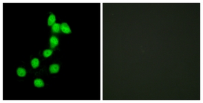Immunofluorescence of HepG2 cells, using DYR1A Antibody. The picture on the right is treated with the synthesized peptide.