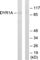 Western blot of extracts from HepG2 cells, using DYR1A Antibody. The lane on the right is treated with the synthesized peptide.