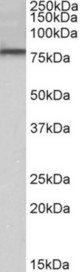 DYRK1A antibody (0.5 ug/ml) staining of K562 lysate (35 ug protein in RIPA buffer). Primary incubation was 1 hour. Detected by chemiluminescence.