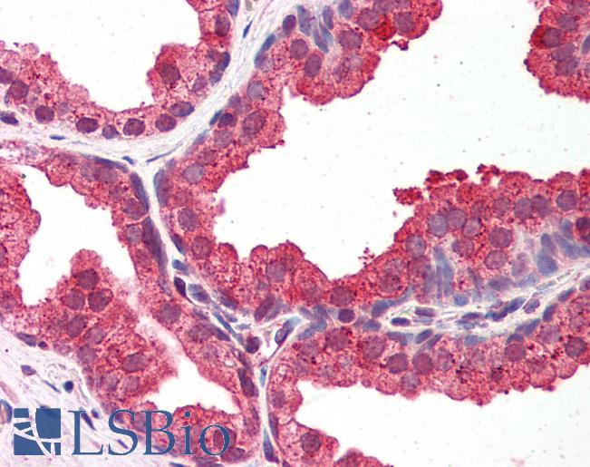 Anti-DYRK1A antibody IHC of human prostate. Immunohistochemistry of formalin-fixed, paraffin-embedded tissue after heat-induced antigen retrieval. Antibody LS-B5890 concentration 5 ug/ml.